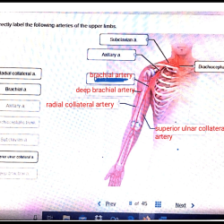 Correctly label the following arteries of the upper limbs