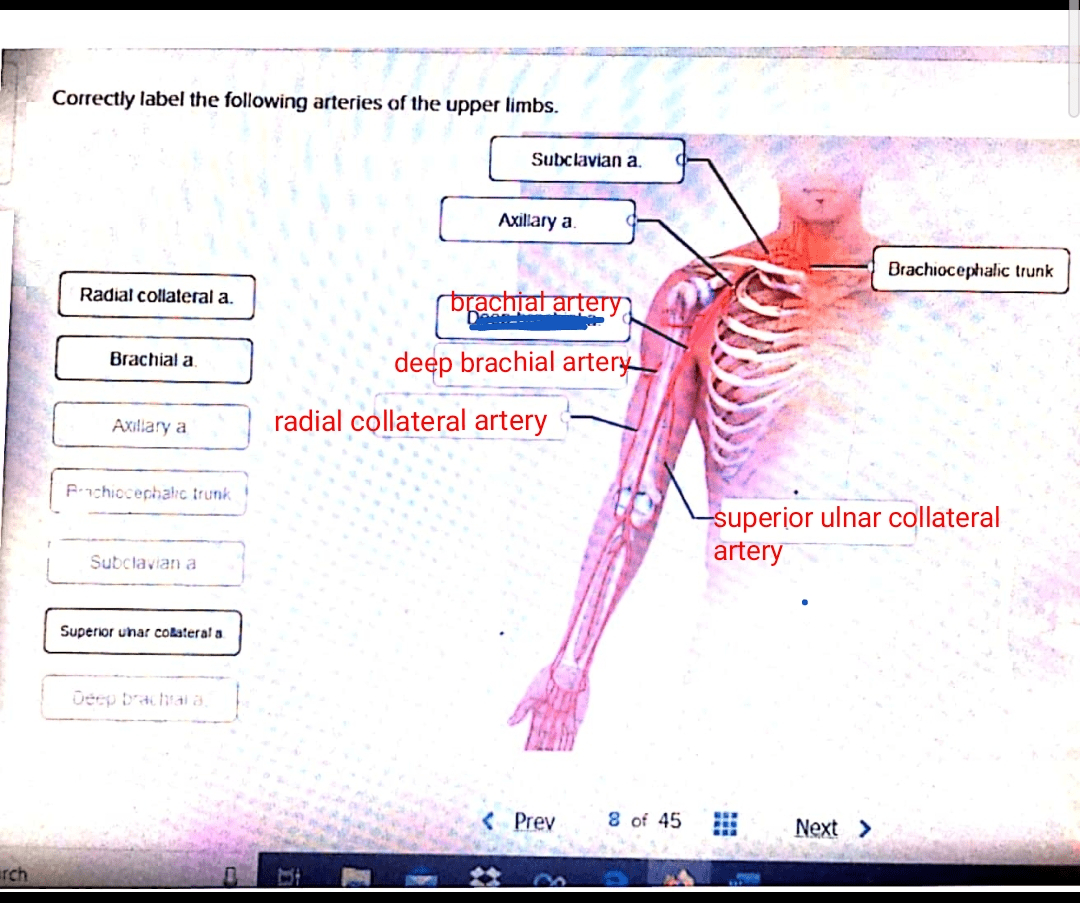 Correctly label the following arteries of the upper limbs